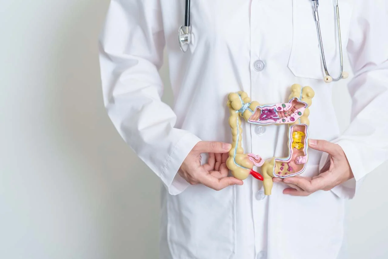 Choosing the Right Surgery for Colorectal Cancer: Minimally Invasive vs. Traditional Open Surgery