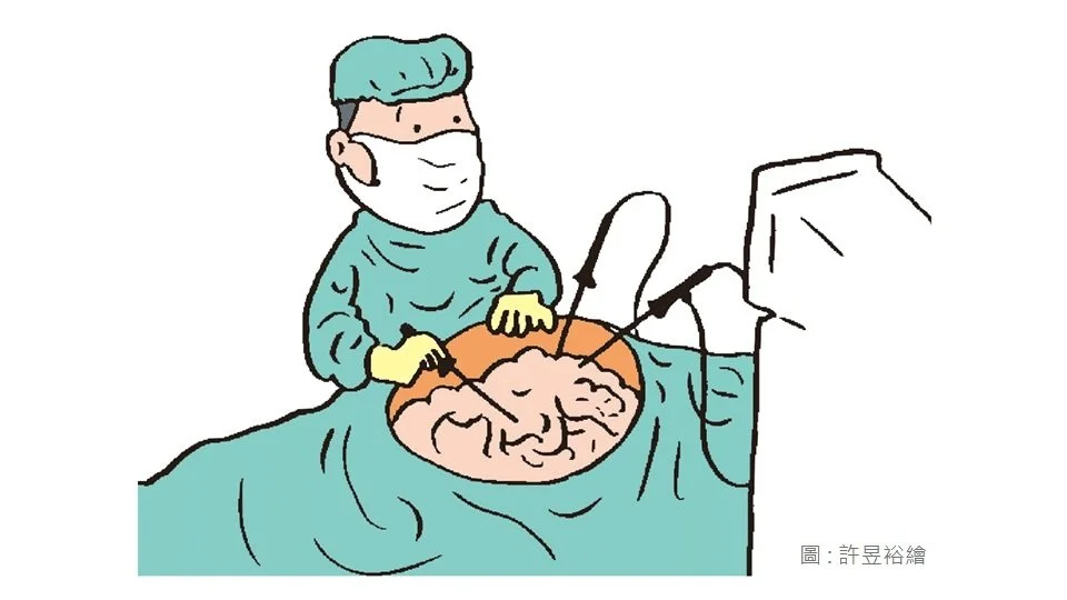 Faster Recovery with Laparoscopic Surgery for Colorectal Cancer at KFSYSCC