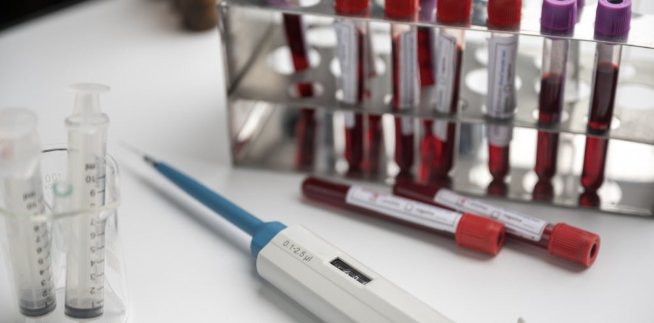 CA-125 and CA-19-9: Twin Beacons in the Search for Ovarian Cancer
