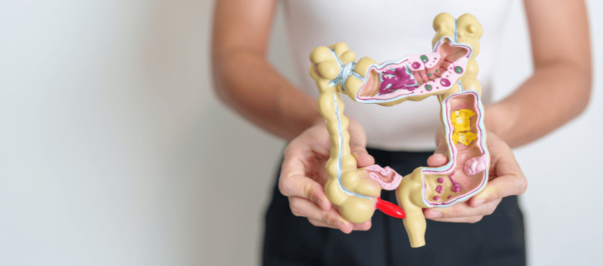 Eating Your Way Back to Health After Colorectal Surgery