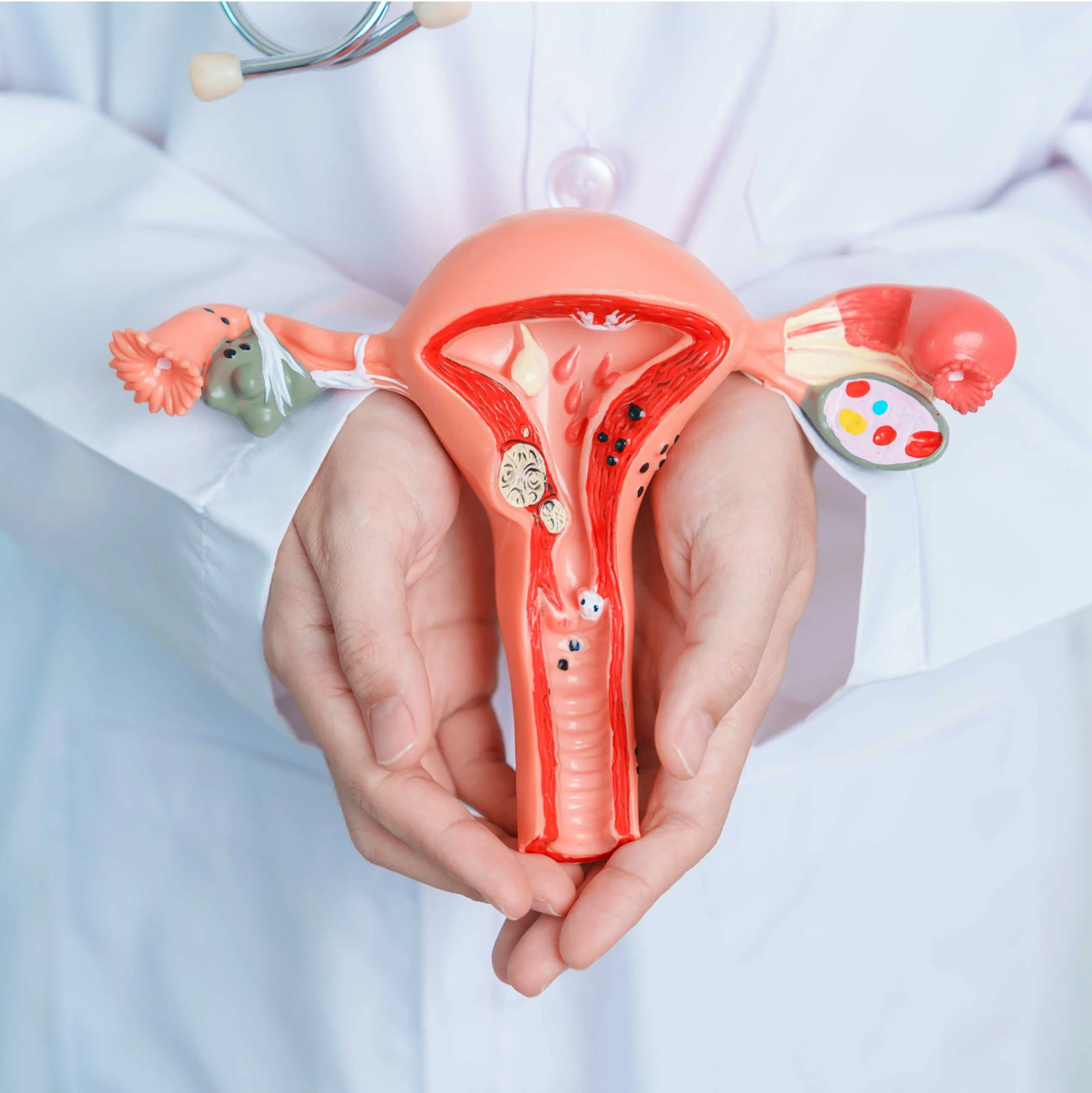 A medical model of the female reproductive system held by a person wearing a white medical coat.