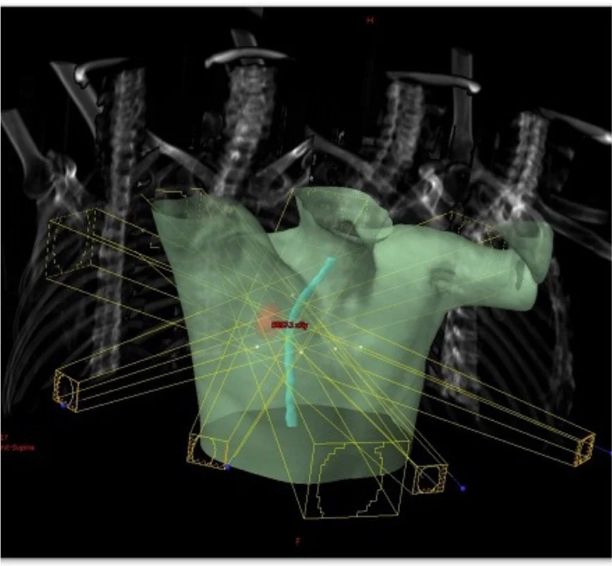 3D digital model of a human torso showing internal organs and pathways, with surrounding skeletal and medical imaging elements.