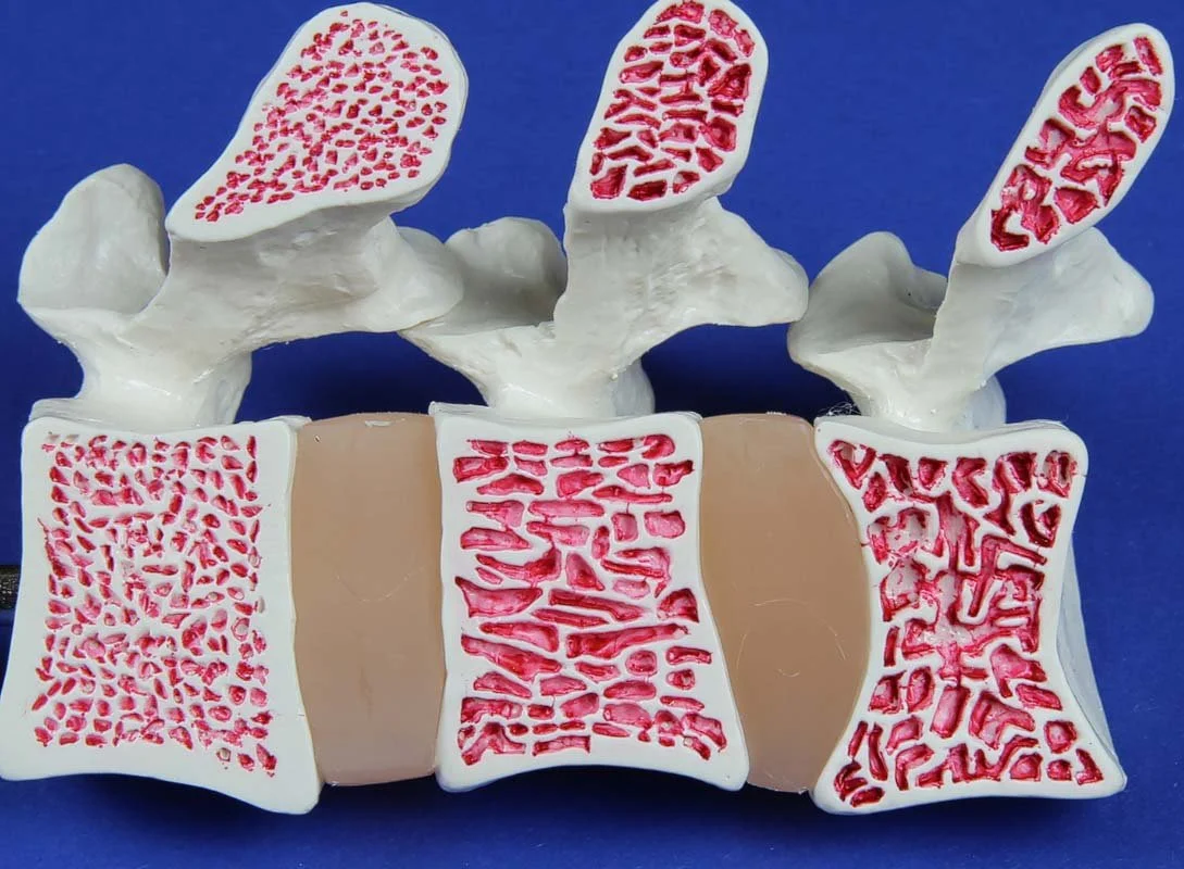 Educational model of a human vertebral column showing cervical, thoracic, lumbar vertebrae, and intervertebral discs.