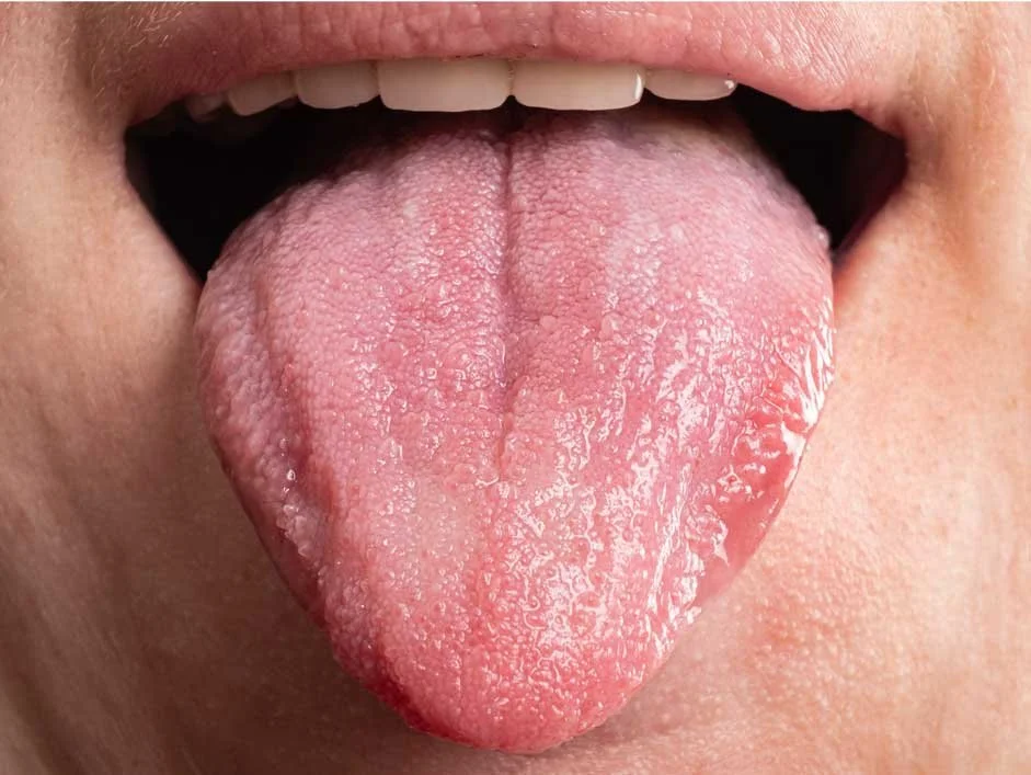 A close-up of a person's mouth with their tongue sticking out.