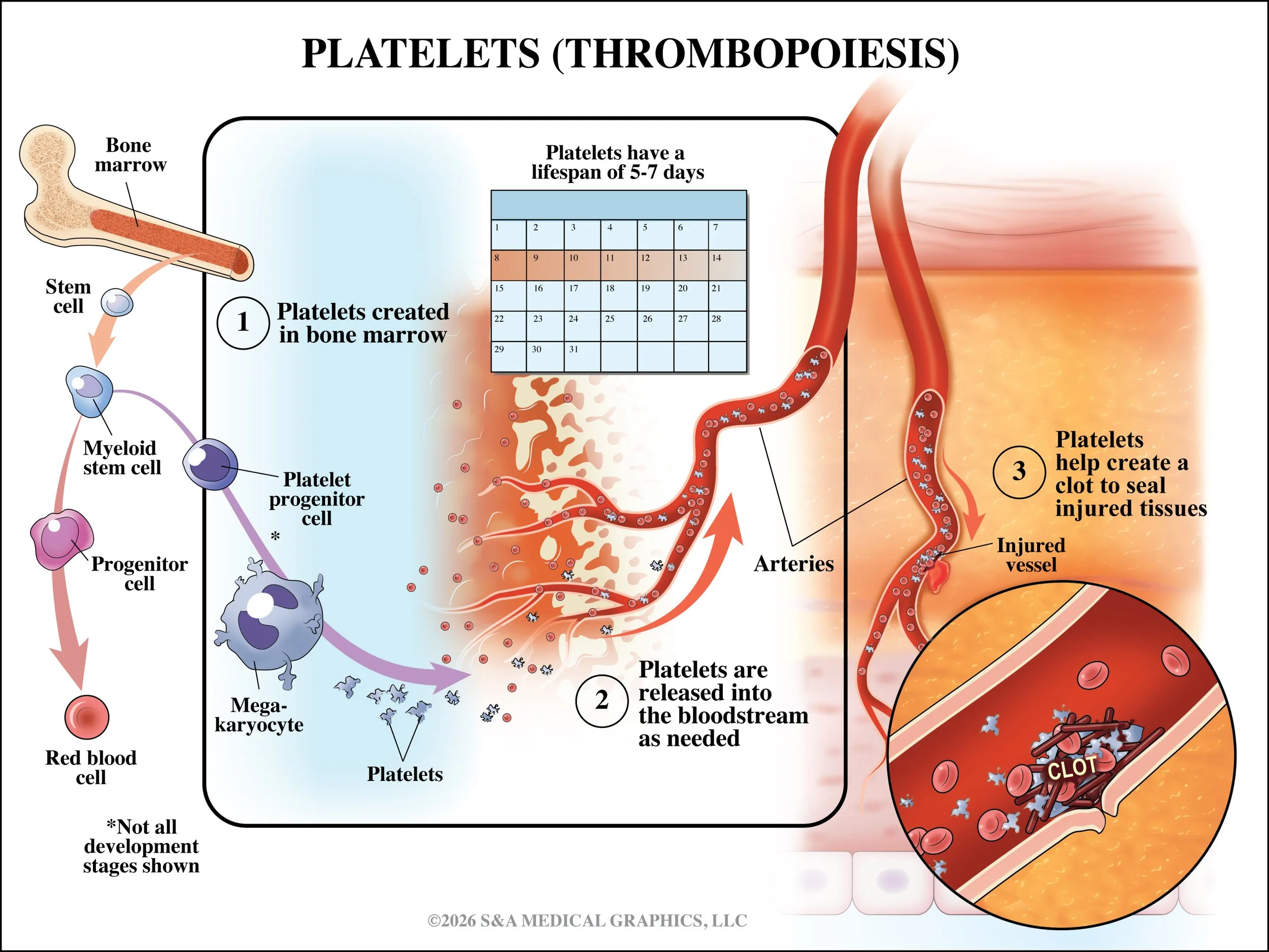 Medical Legal Exhibit | Made as medical illustrator for S&A Medical Graphics LLC