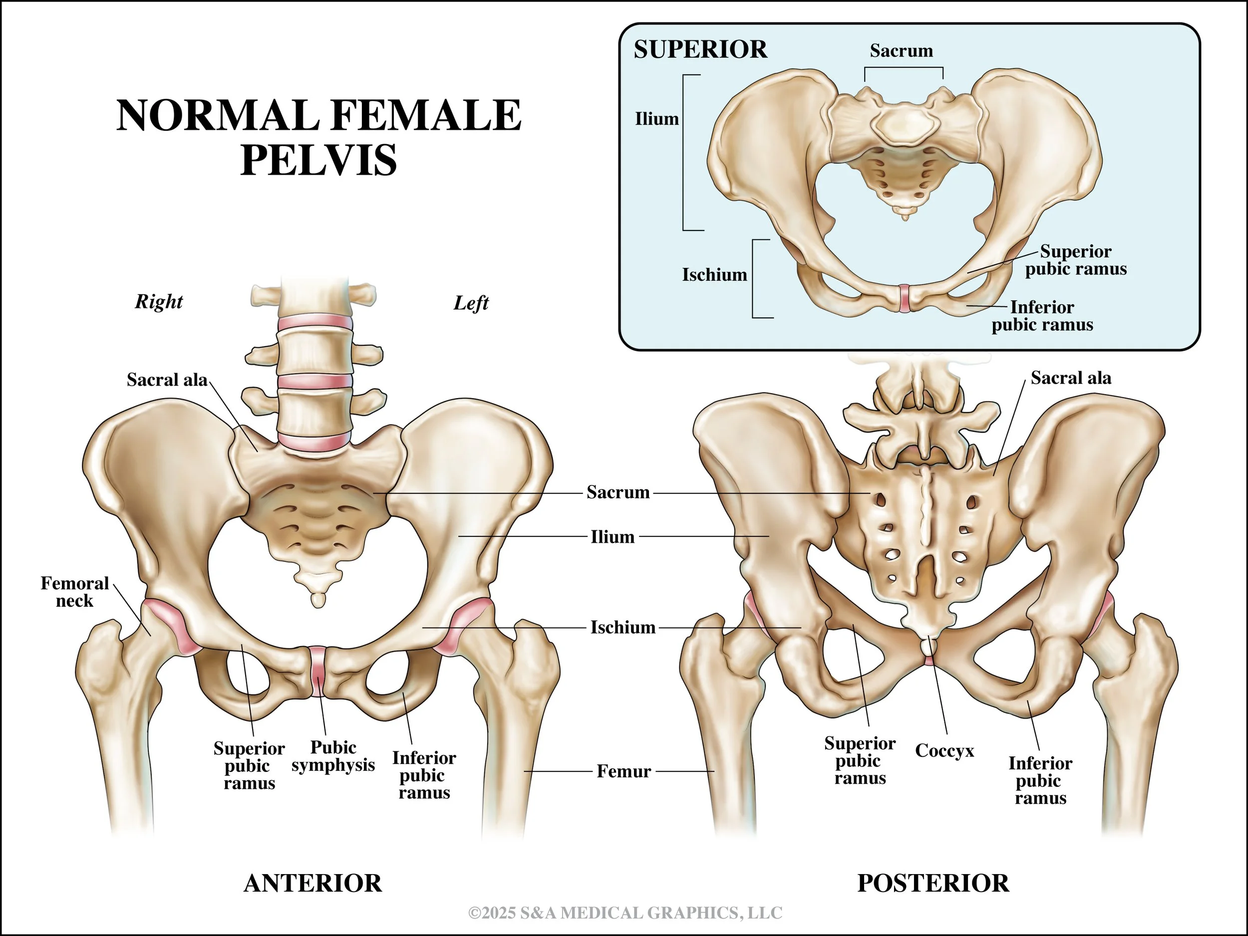 Medical Legal Exhibit | Made as medical illustrator for S&A Medical Graphics LLC | 