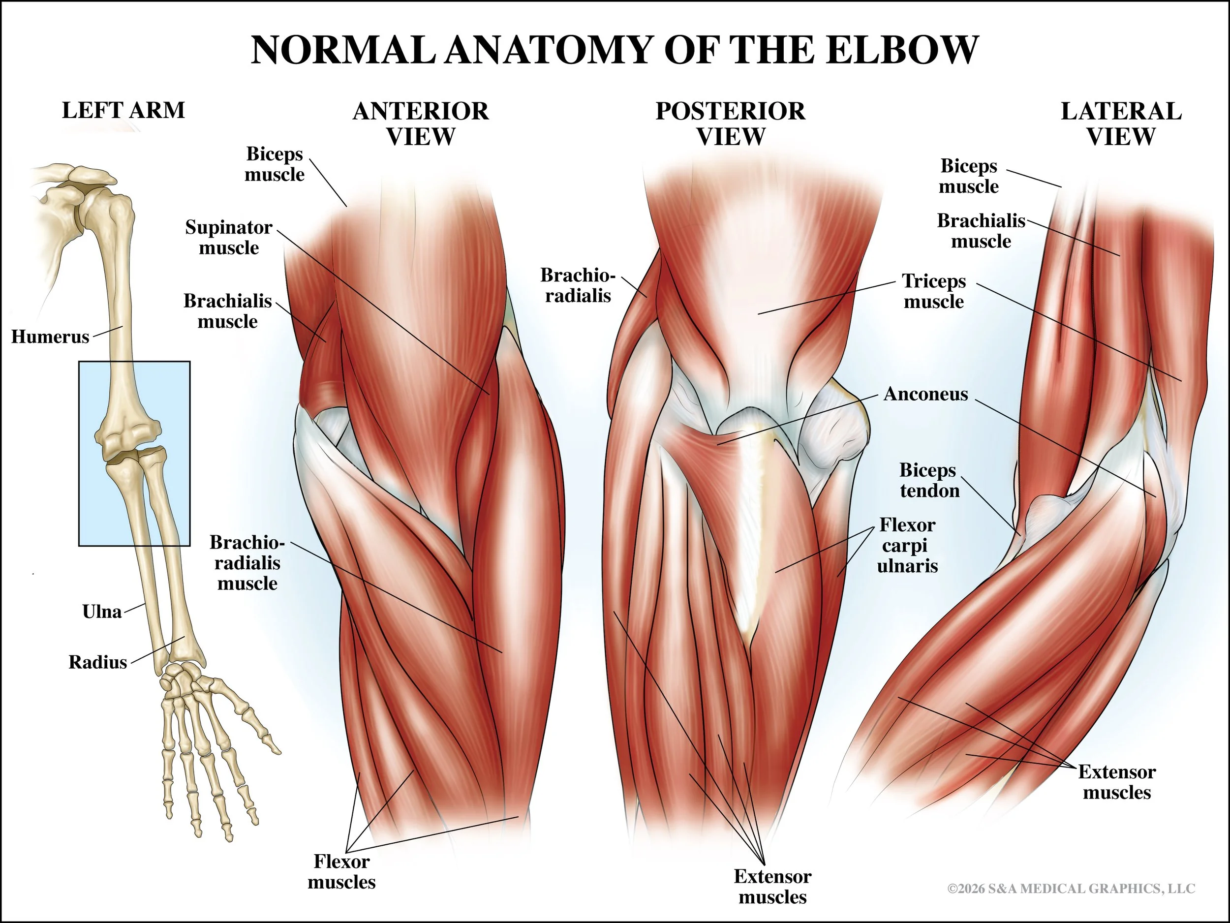 Medical Legal Exhibit | Made as medical illustrator for S&A Medical Graphics LLC 
