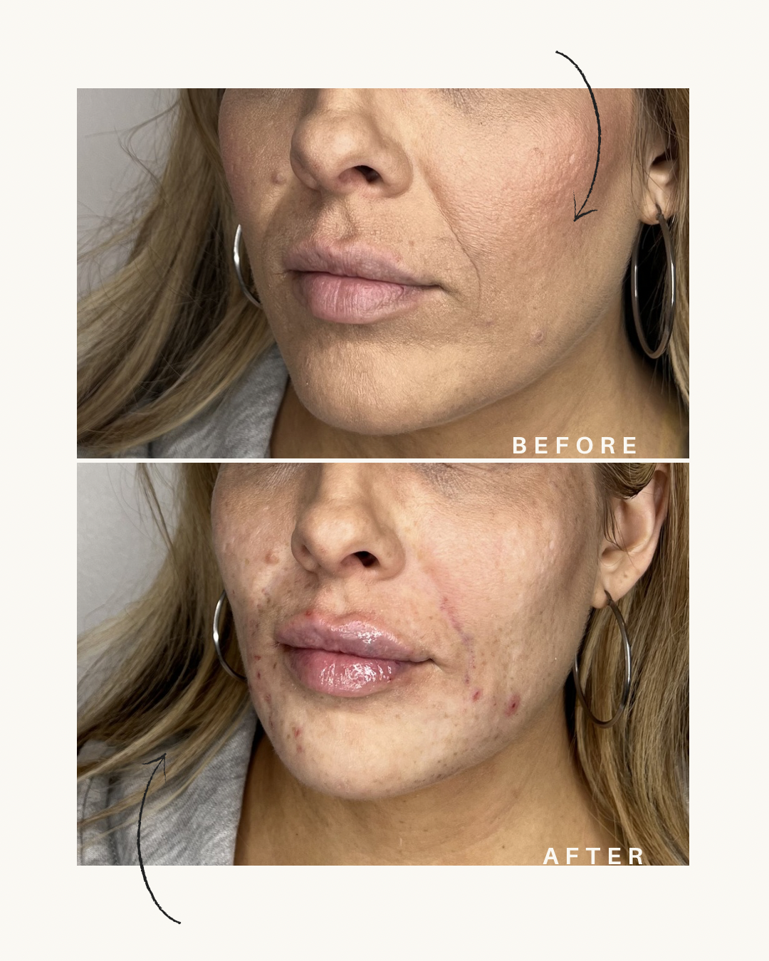 Green and Beige Minimalist Skincare Before After Collage Instagram Post.png