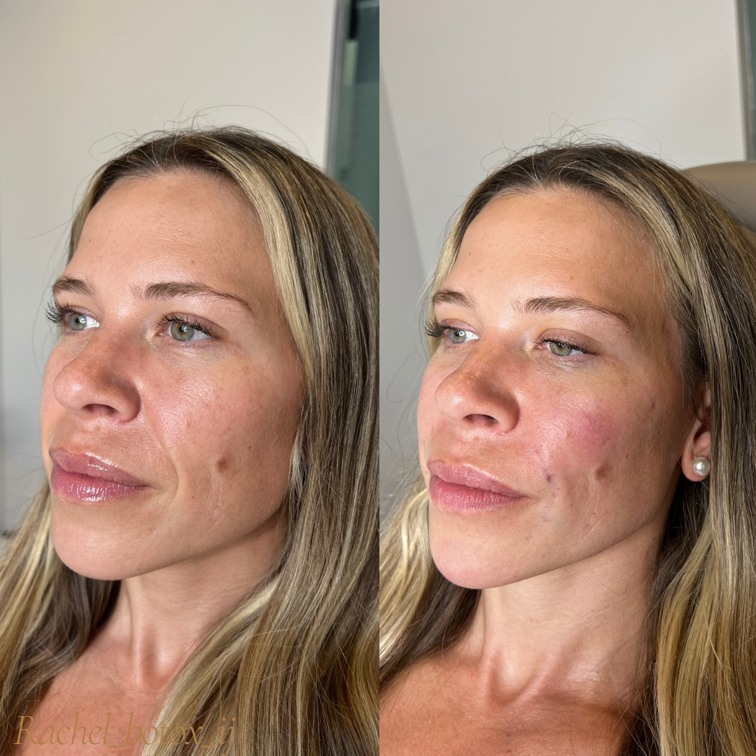 Neutral Before and After Instagram Post - 1.png