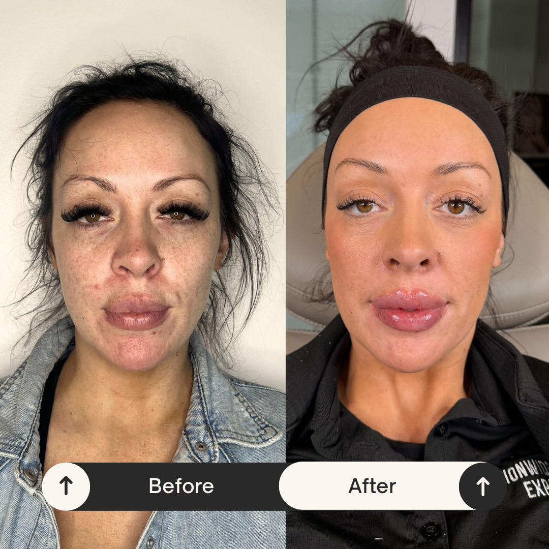 Beige Minimalist Skincare Before and After Instagram Post.png