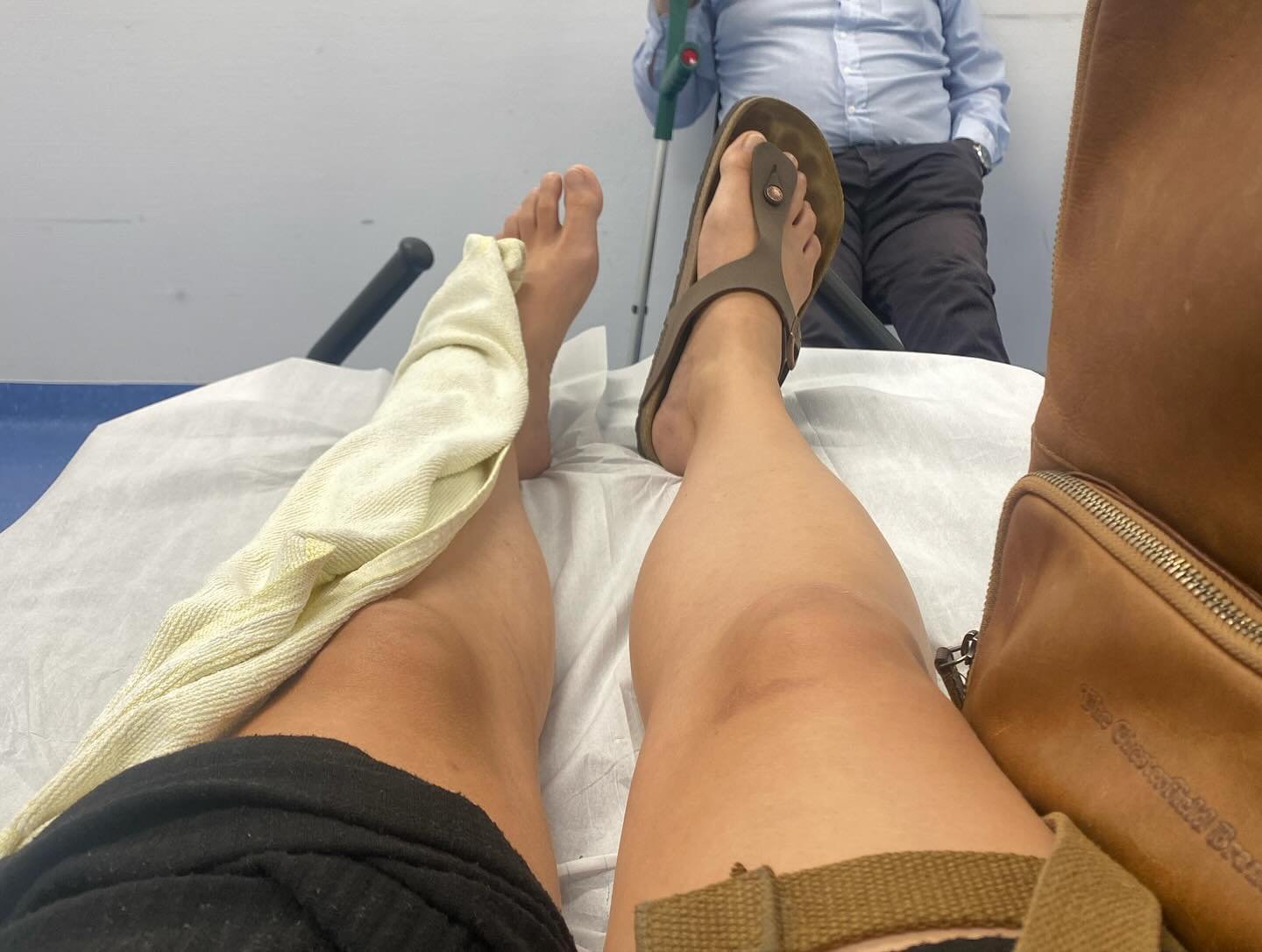 I fell off my bike last week. At first, I thought I had only injured my hand but my left leg started hurting massively, and the pain got so bad that I couldn&rsquo;t put any weight on it anymore. Every small movement hurt, so I went to the emergency 