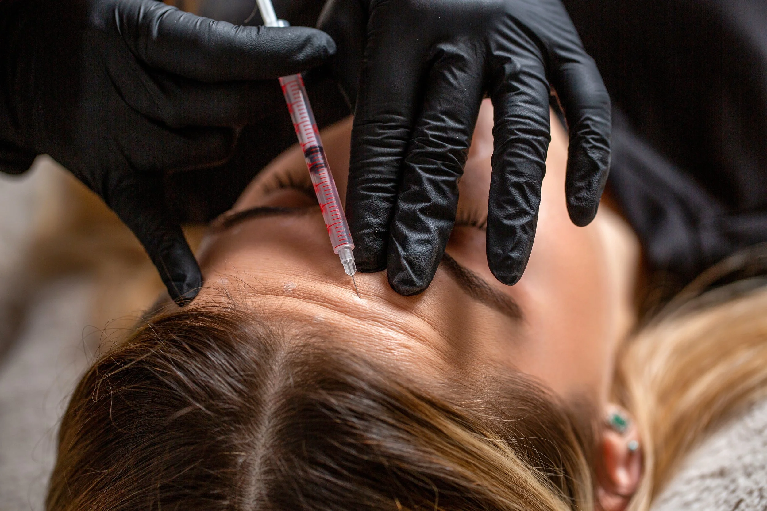 How Sun Exposure in Tampa Impacts Wrinkle Formation, And How BOTOX Can Help