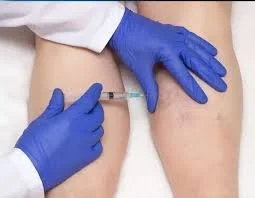 calf reduction botox