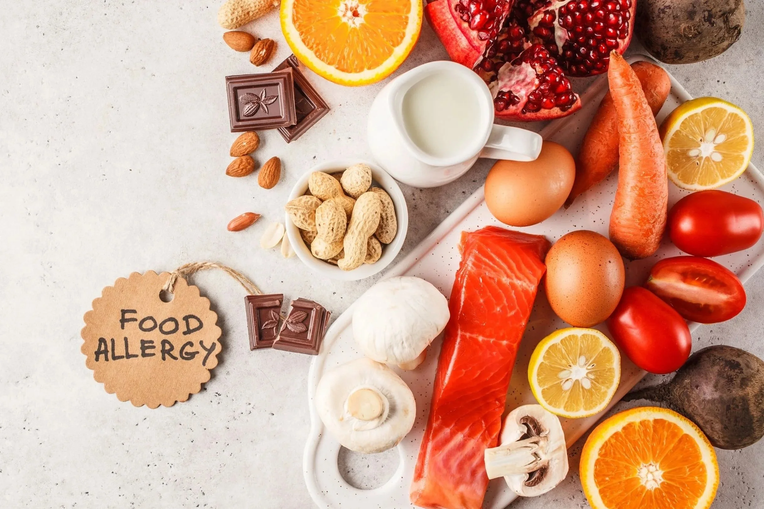 Navigating food allergies &amp; intolerances