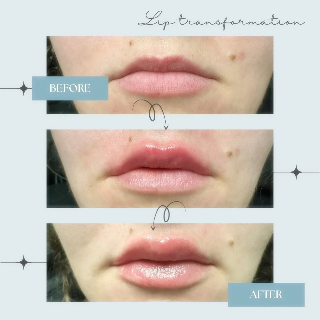 Lips 3.jpg