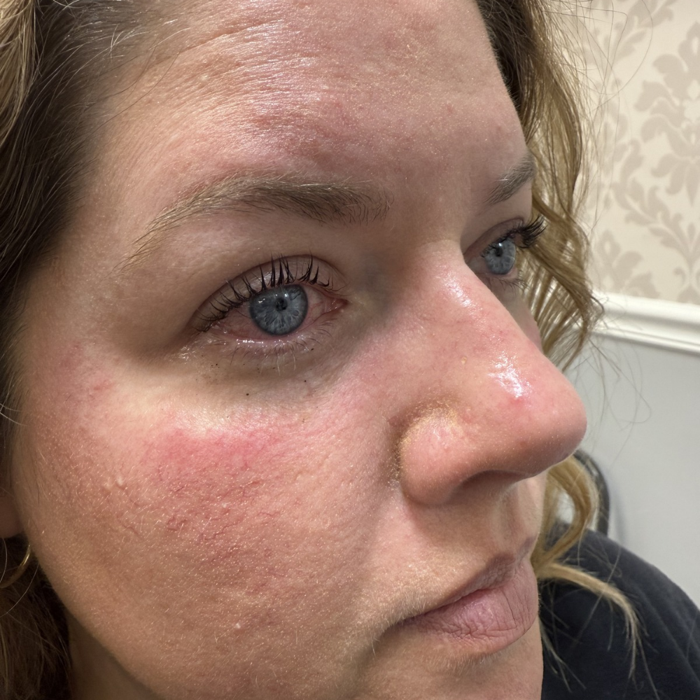 Lash Lift and Tint