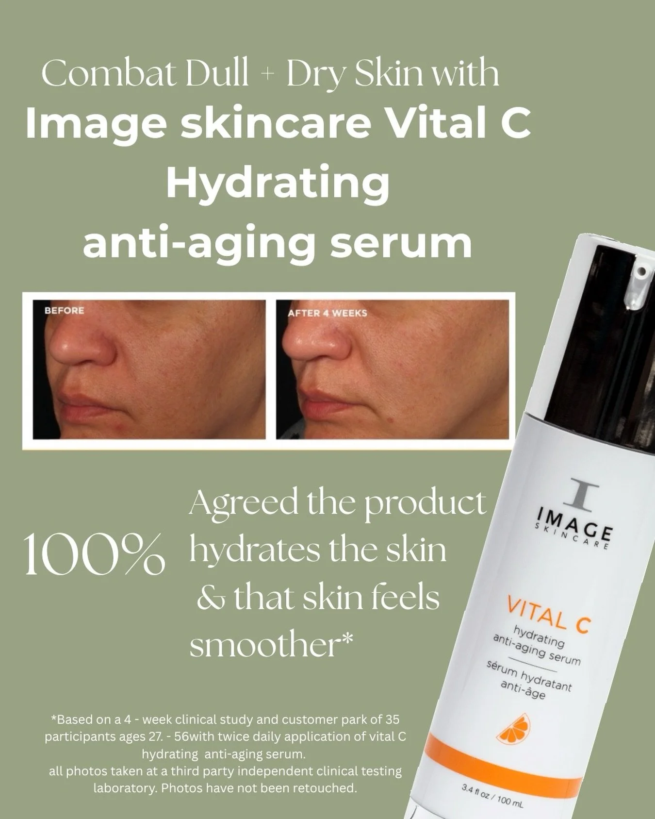 ADVANCED ANTIOXIDANT THERAPY FOR LUMINOUS SKIN.

Vital C hydrating anti-aging serum is bought every minute world wild for its much loved formula ❤️ This physician-formulated serum combines stabilized Vitamin C with hydrating actives to:

&mdash; Impr
