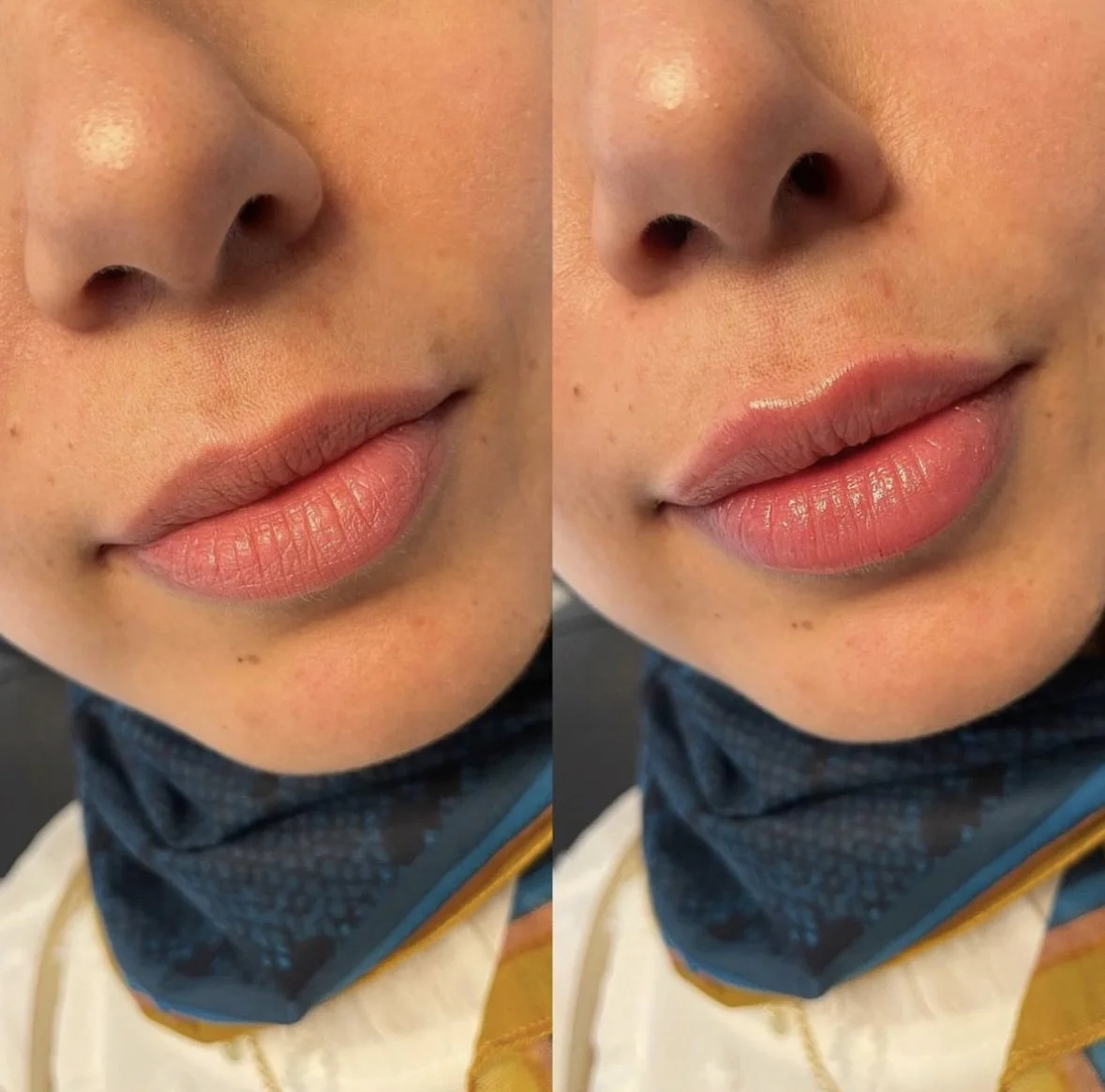 Before & Immediately After