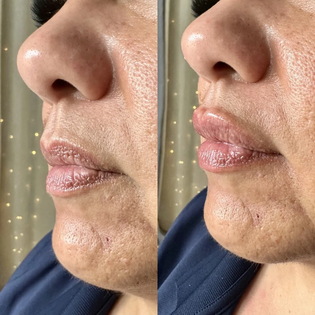 Before & Immediately After