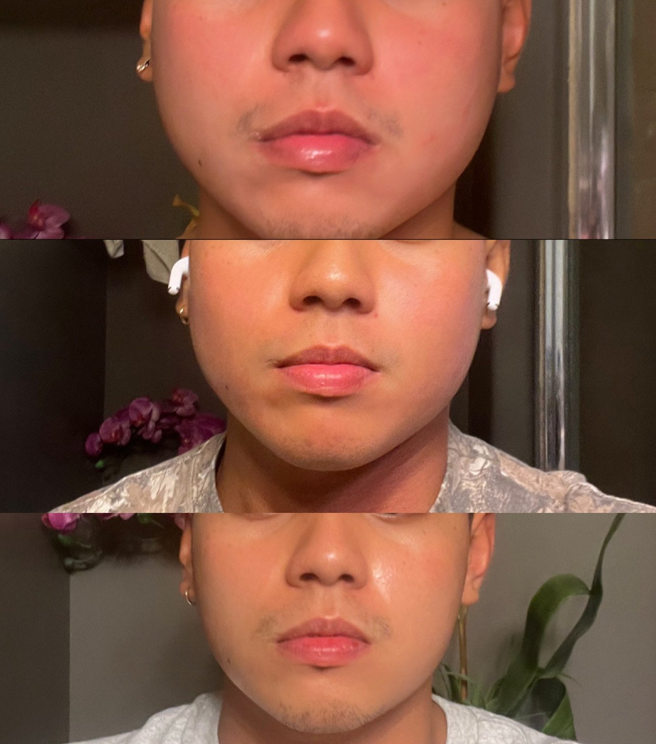 Close-up of a person's face showing a comparison of their lips and chin in three horizontal sections, with different backgrounds and clothing in each section.