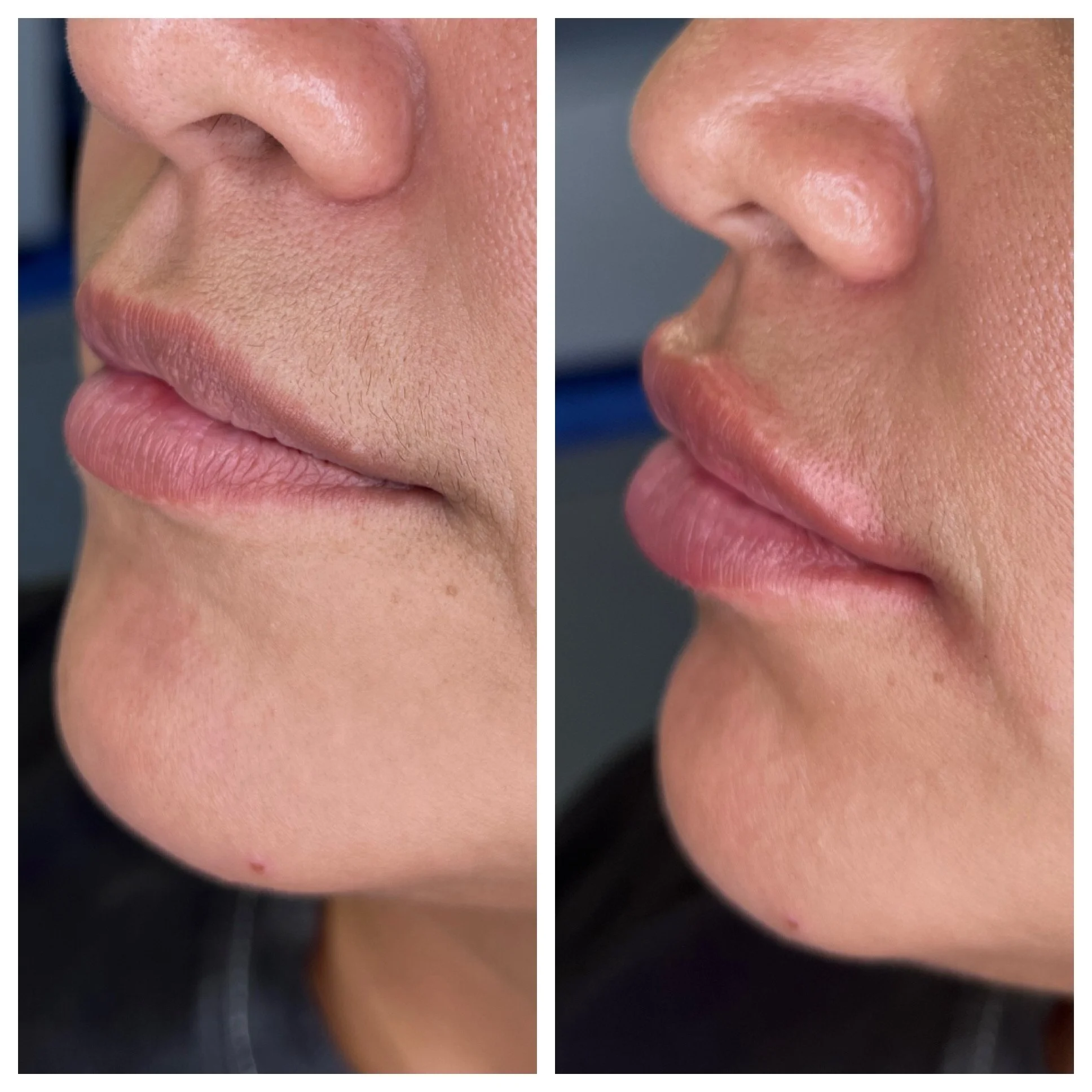 Before & Immediately After