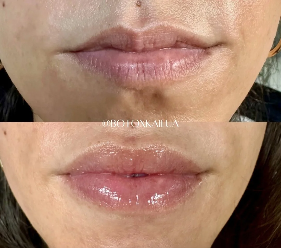 Close-up of lips before and after lip gloss application, showing fuller and shinier lips in the after photo.