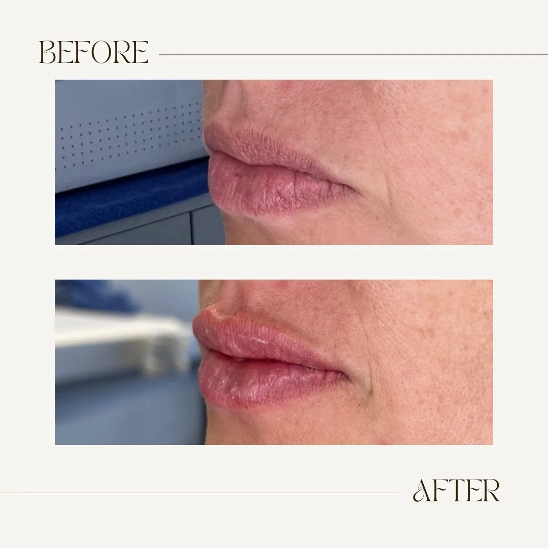 Before & Immediately After