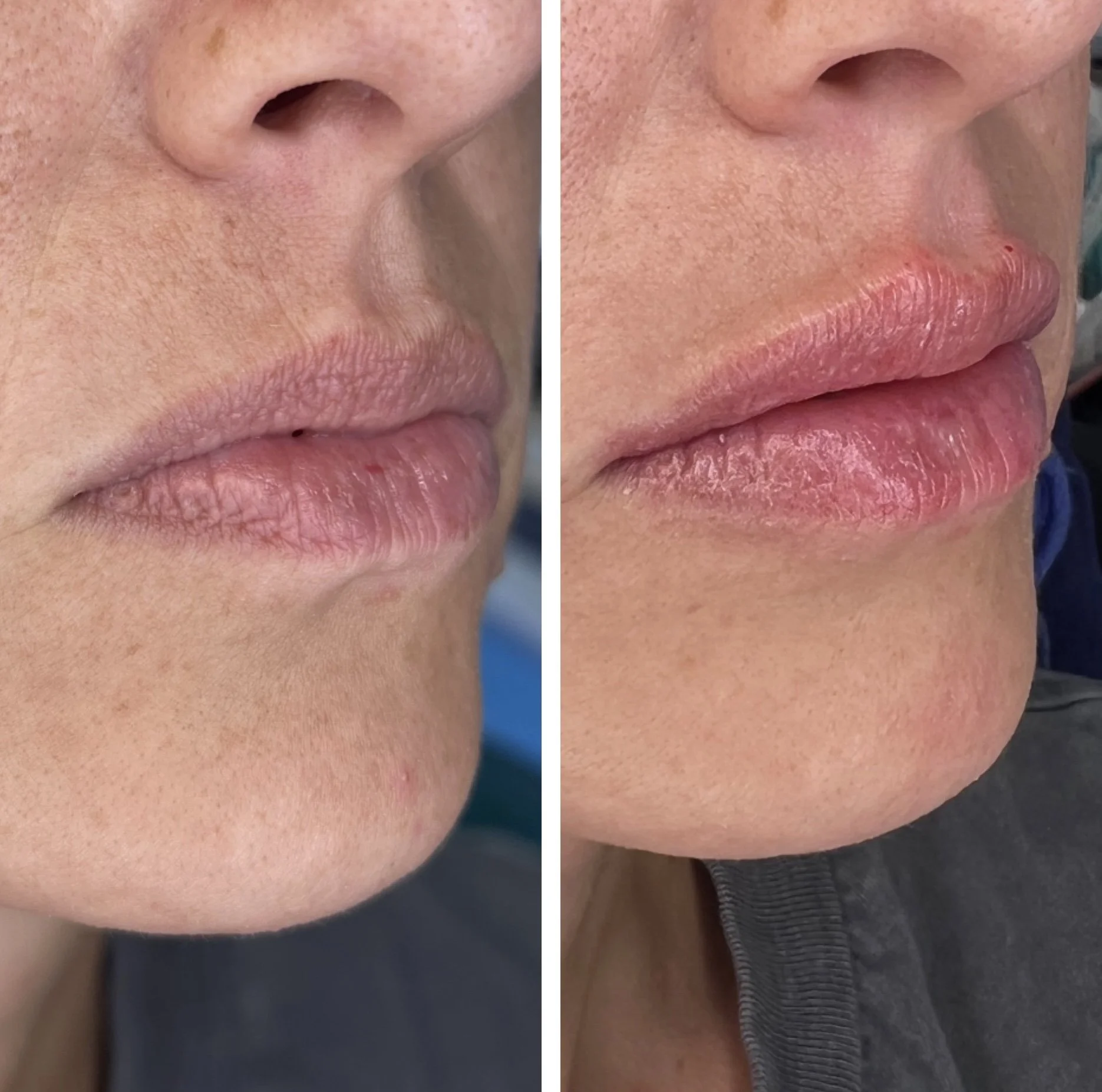 Before & Immediately After