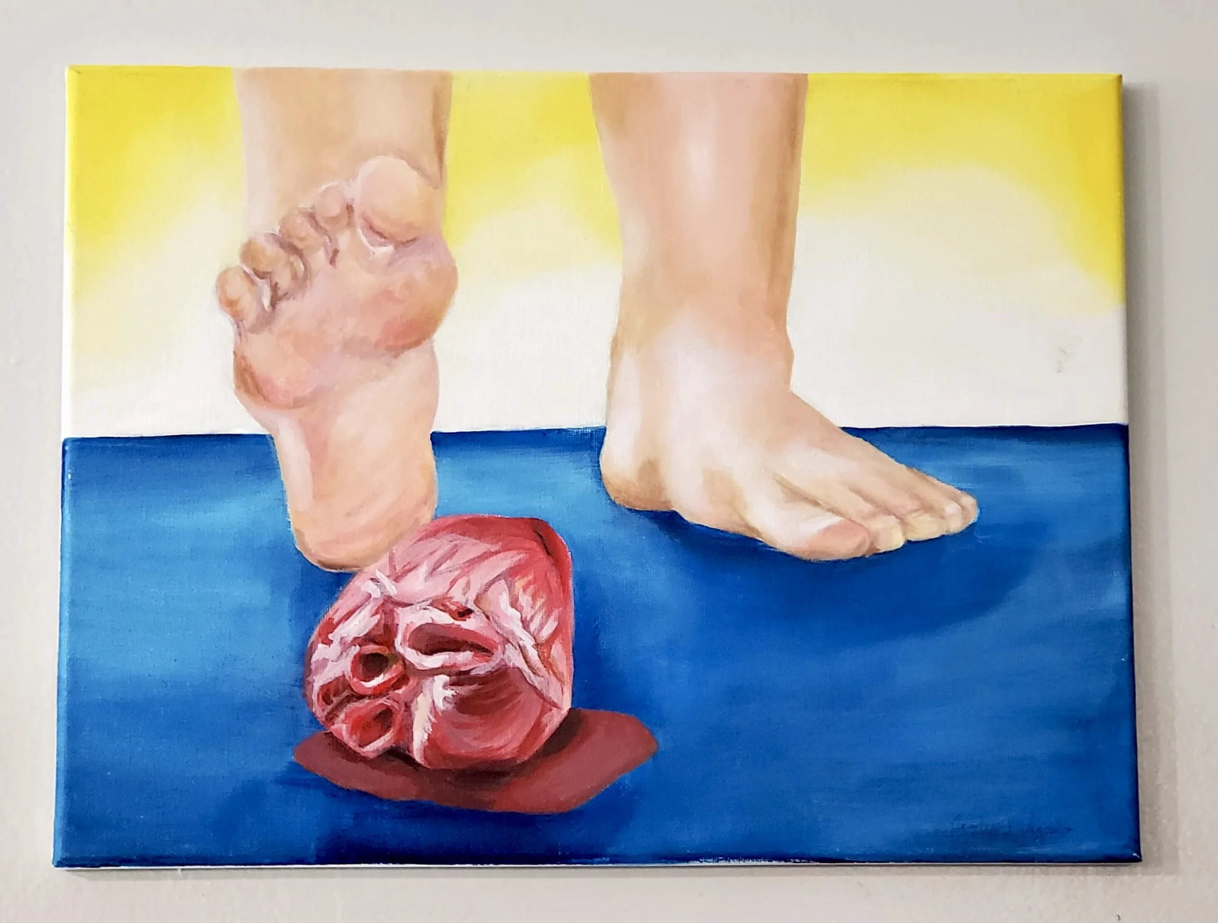 Stomped on by Jocelyn Mulgado