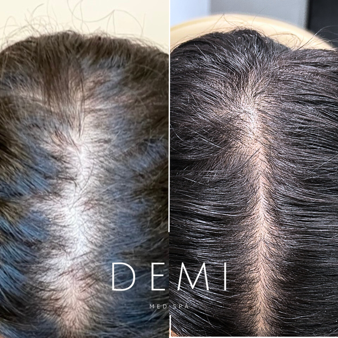 Hair Rejuvenation  BA - Feed.png