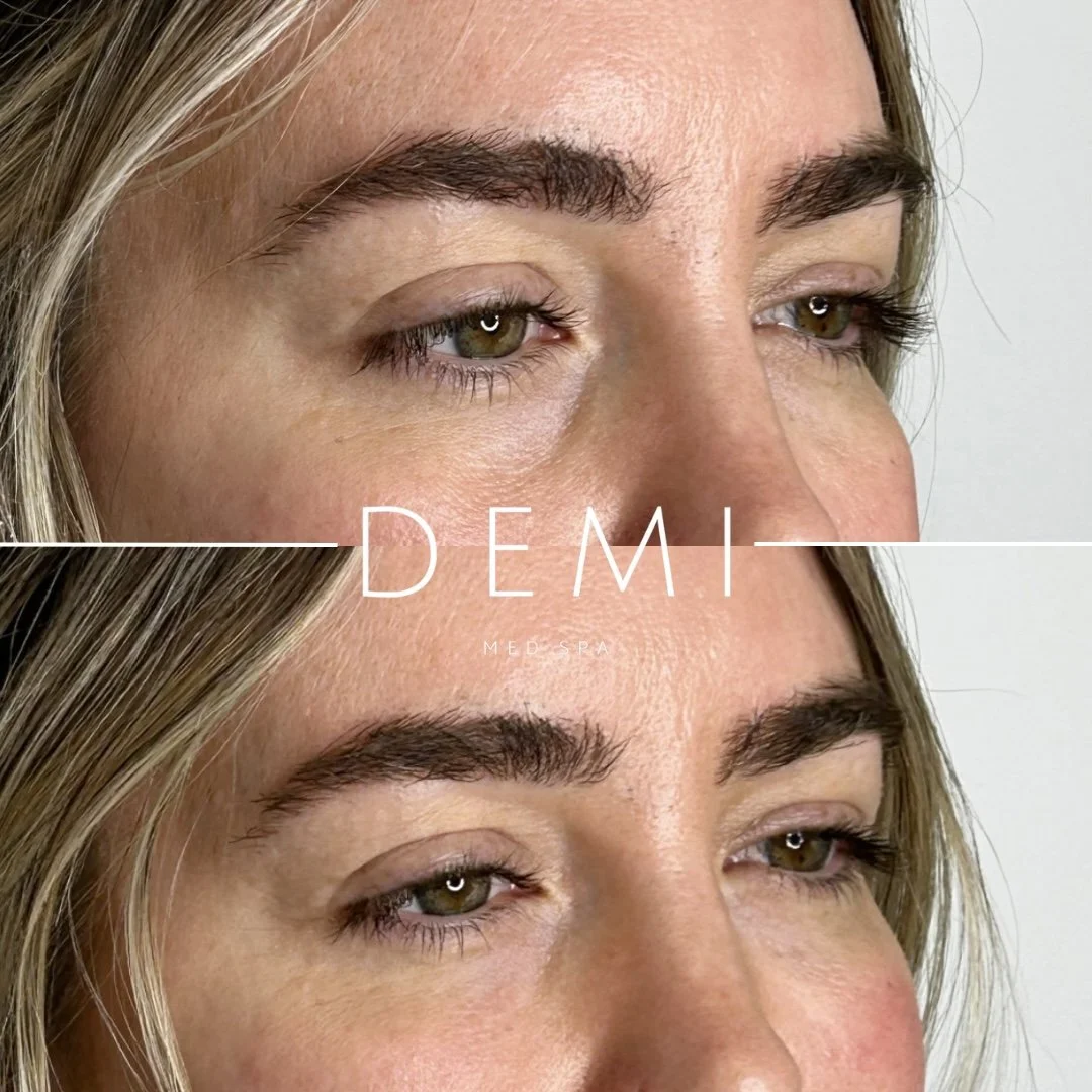 EZ GEL PRF - feed - Dana 4.jpg