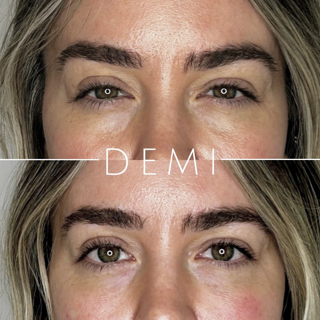 EZ GEL PRF - feed - Dana 3.jpg