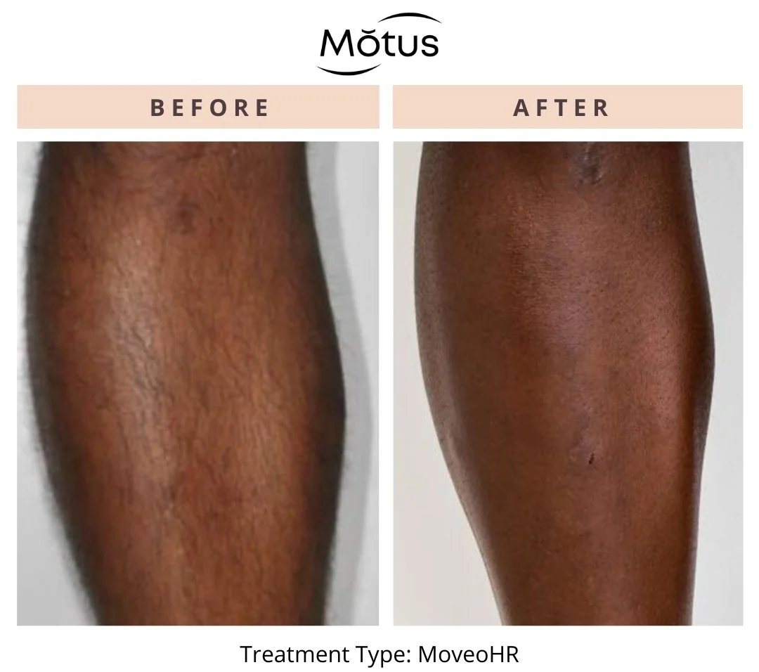 Motus1168970869299.jpg