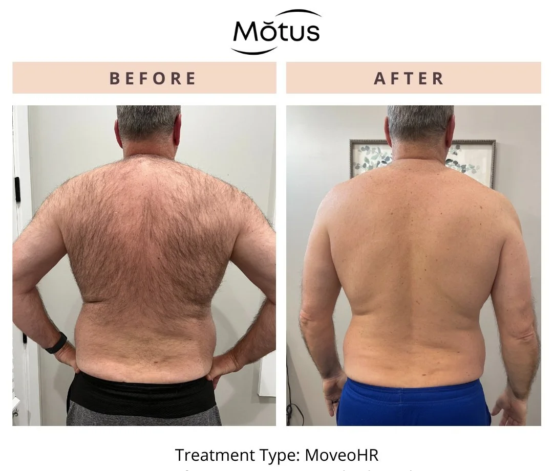 MotusBAContest3168971017755.jpg