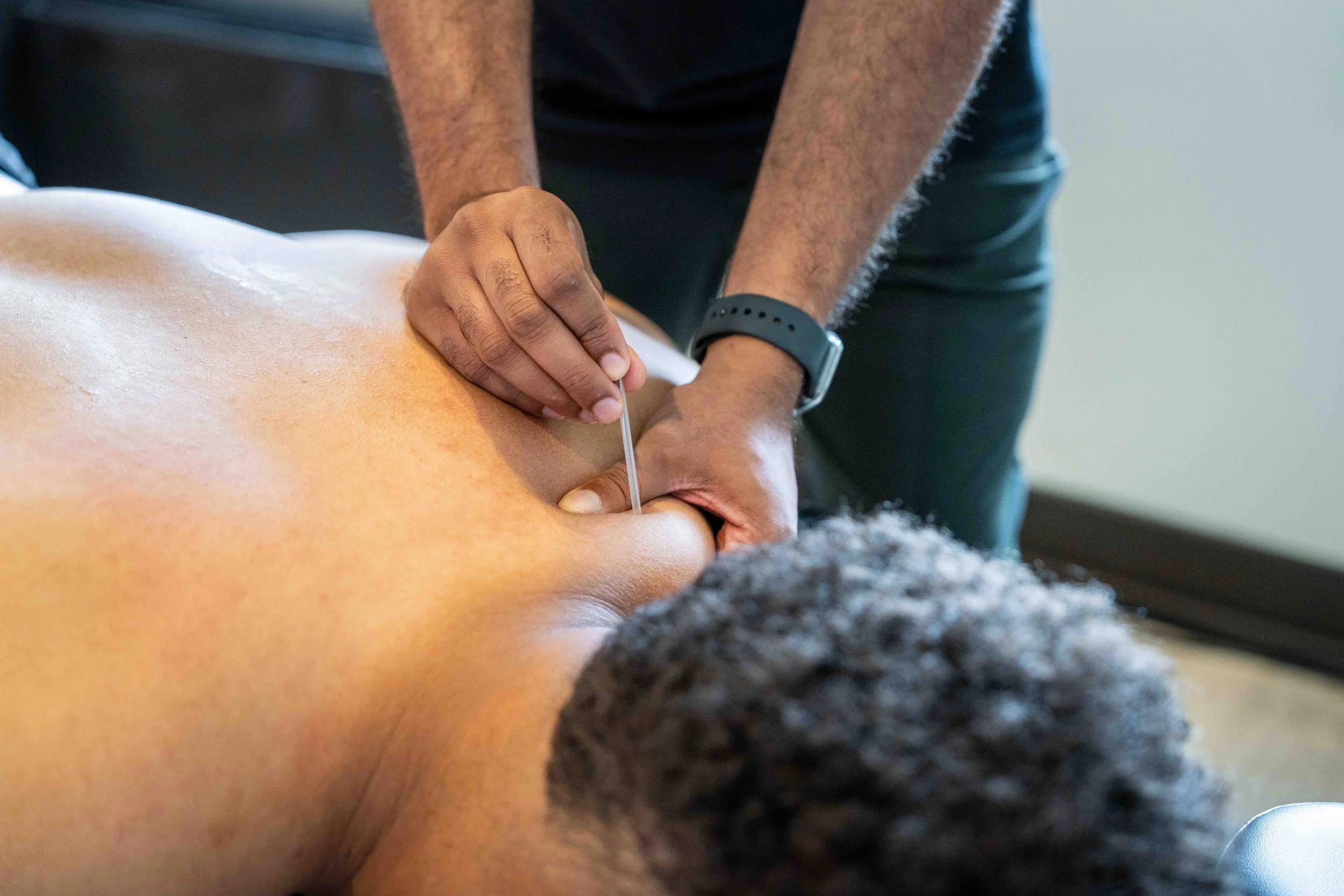 Medical Acupuncture done by massage therapist and chiropractor in Pickering