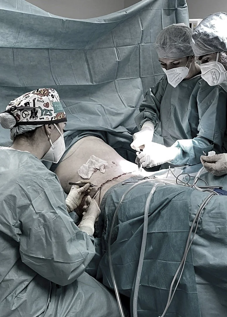 Bauchdeckenstraffung