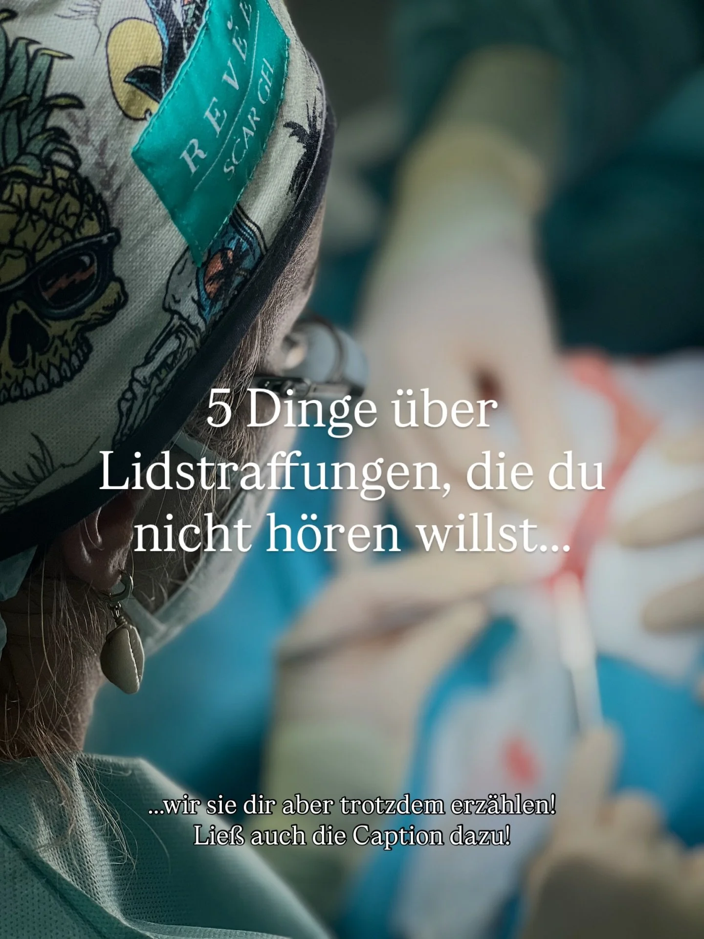 .
LIDSTRAFFUNG &amp; WAS DU NICHT H&Ouml;REN WILLST!

Lidstraffungen geh&ouml;ren zu unseren h&auml;ufigsten Operationen &amp; die Komplikationsrate ist in unseren H&auml;nden gering.
Trotzdem k&ouml;nnen Probleme und &bdquo;Nebenwirkungen&ldquo; auf