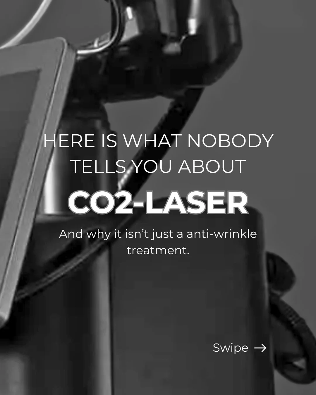 .
CO2-LASER

Eine Behandlung die f&uuml;r Narben, Falten, Straffung &amp; Intimgesundheit geeignet ist?

Der Hybrid-CO2-Laser kann viel mehr, als nur F&auml;ltchen optimieren.

Voraussetzung ist eine individuelle Beratung und Planung, denn nicht jede