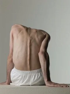 Anorexia, Trauma, and Internal Family Systems (IFS): Understanding the Inner System Behind the Disorder