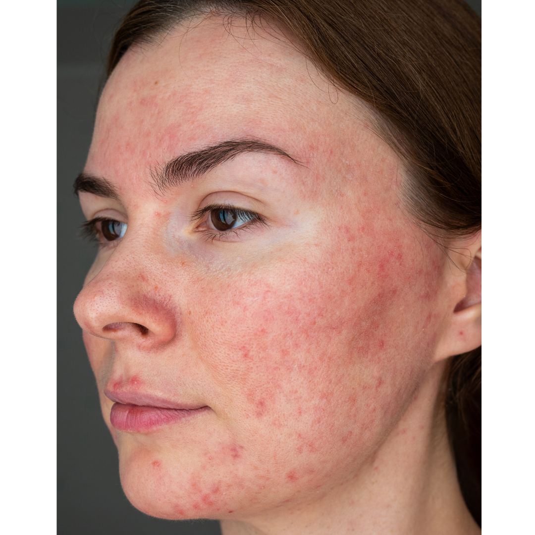 Understanding Skin Conditions Expert Insights & Treatment Options at