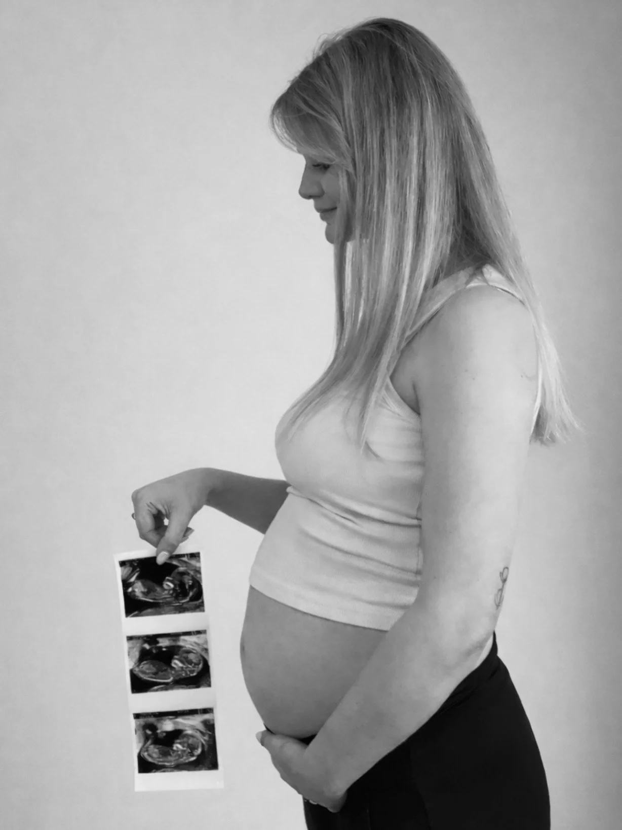 Our little rainbow baby is finally on their way 🌈🤍

Pregnancy after loss brings with it many emotions. There is so much excitement, joy and love but alongside that comes anxiety and dread. My pregnancy with Rudy feels almost innocent in comparison.