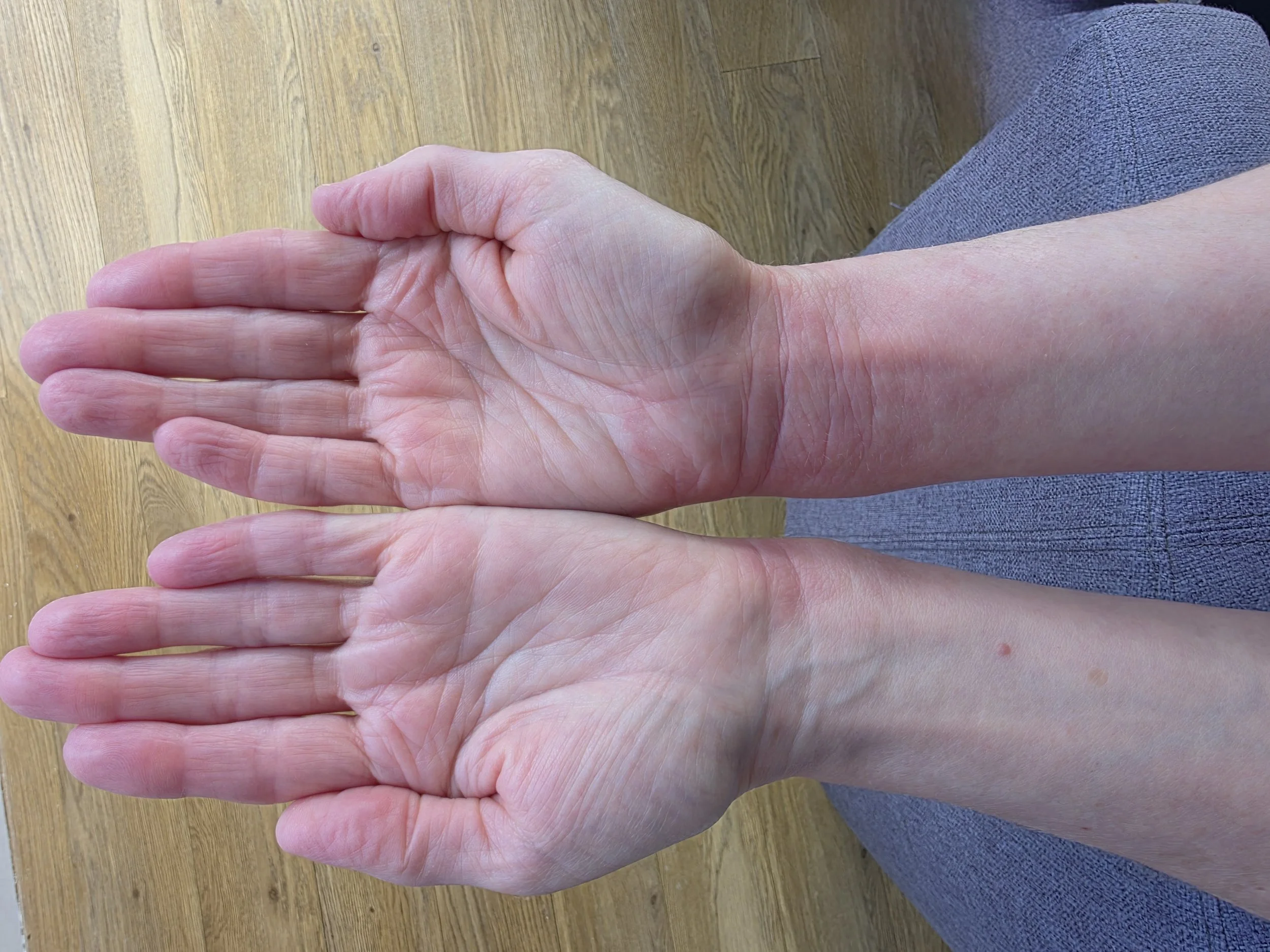 Histamine Hell - Tamed