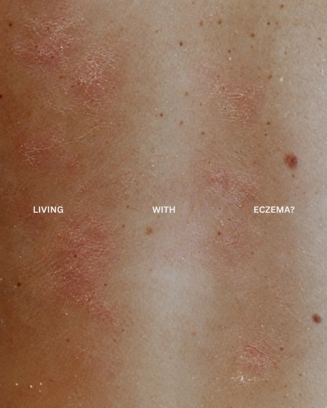 Do you struggle with eczema or recurring flare-ups?

We&rsquo;re currently looking for panelists for an upcoming eczema skincare study at Prestige Testing.

If you experience eczema and are interested in testing skincare products and sharing your fee