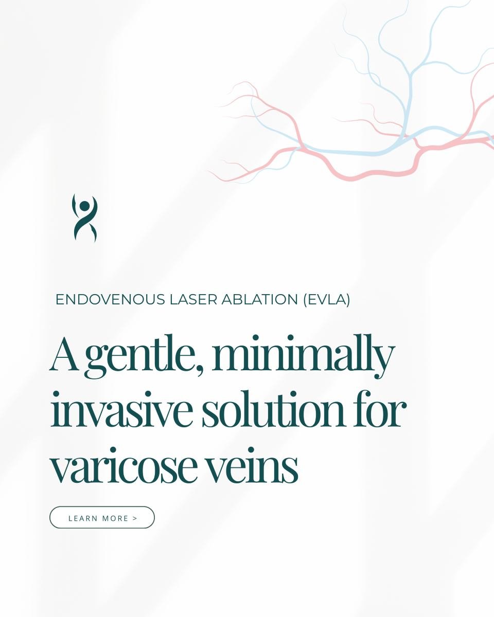 Your legs shouldn&rsquo;t feel heavy, sore, or hold you back.

If varicose veins are becoming more than just a cosmetic frustration, EVLA (Endovenous Laser Ablation) could be a gentle way forward.

This minimally invasive treatment uses laser energy 