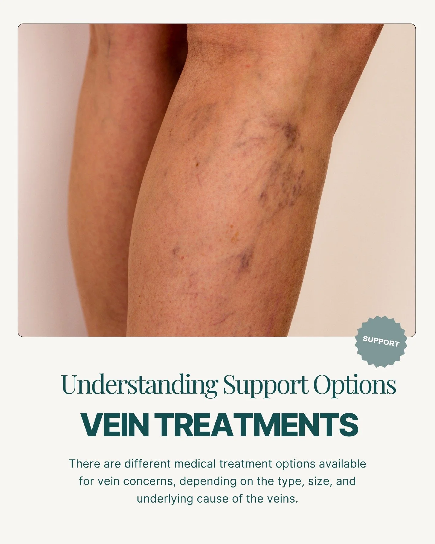 Visible or uncomfortable veins can be influenced by a range of factors, including genetics, pregnancy, hormonal changes, occupation, and age. For some people, vein concerns are primarily cosmetic, while for others they may be associated with symptoms