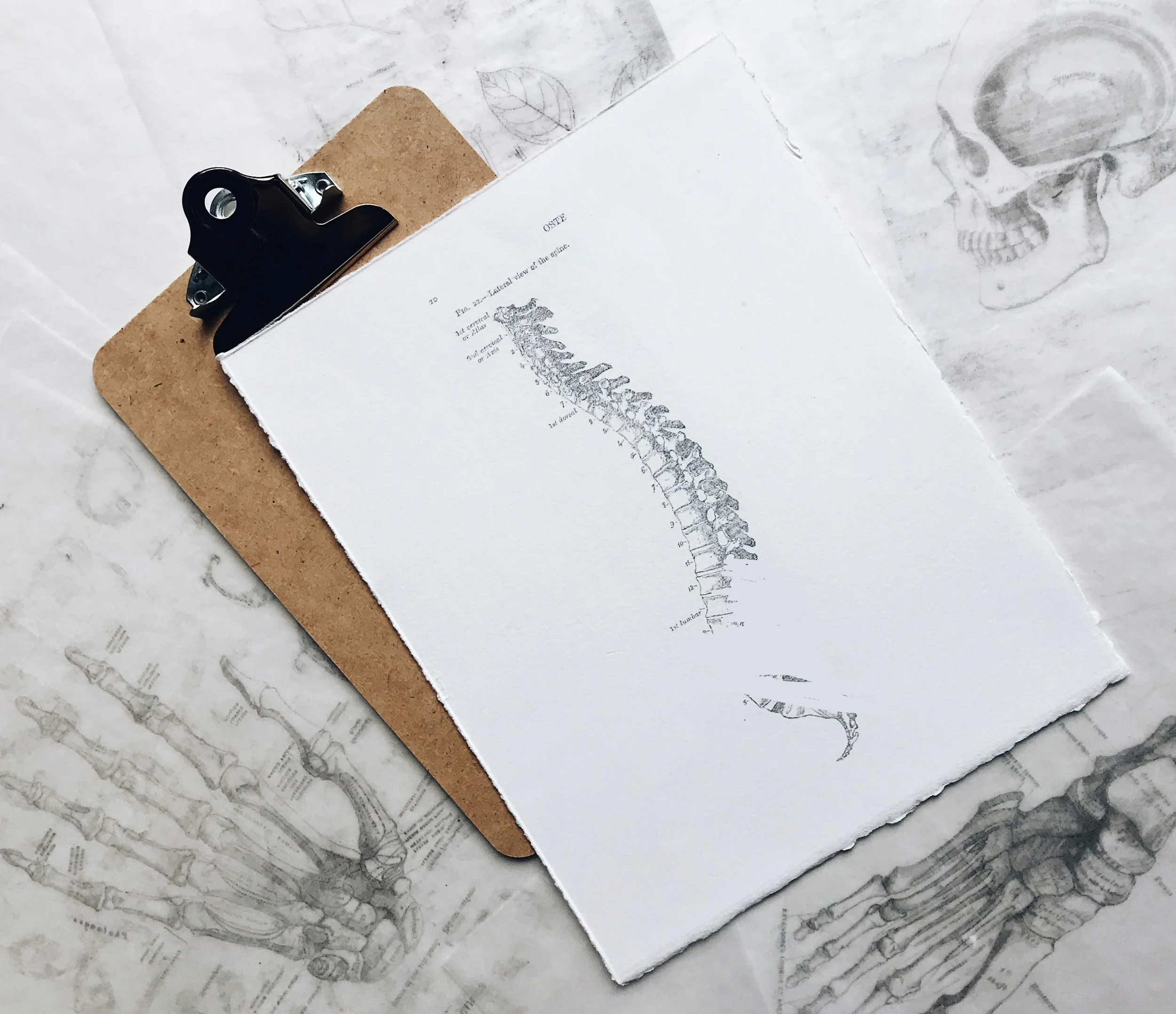 Disappearing Spines