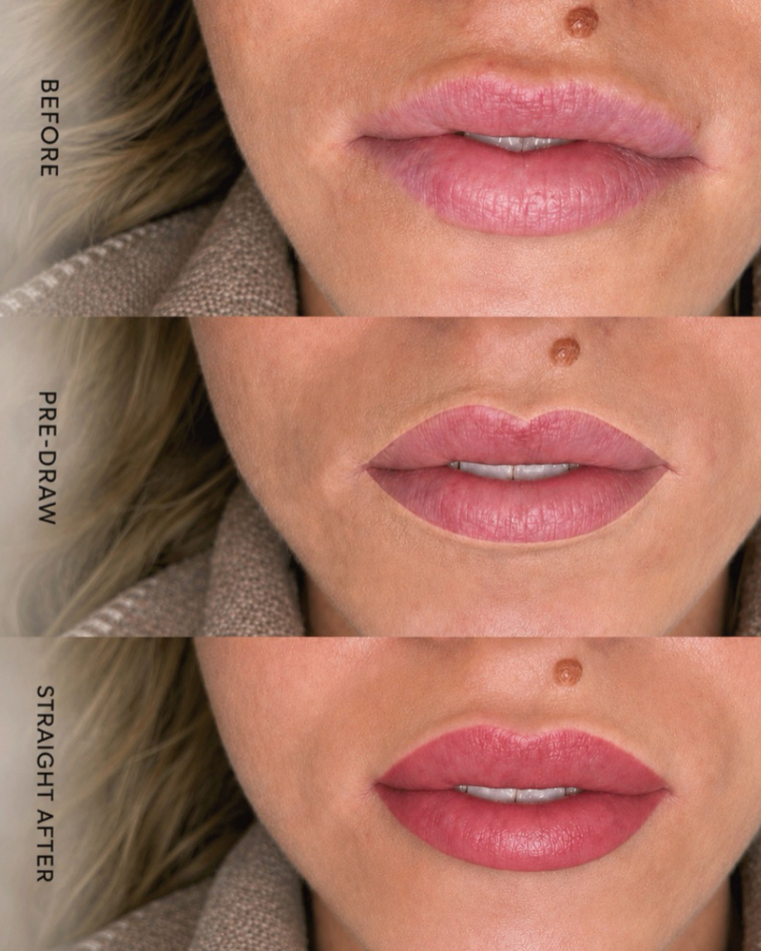 Comparison of lips before, pre-draw, and straight after applying lipstick, showing progression of makeup application.