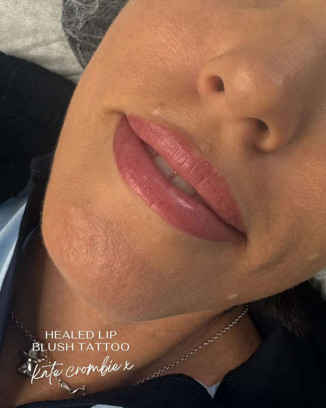 Hello summer glow up ✨

There is nothing more satisfying than seeing my clients for their final Lip Blush touch-up. 

As you can see here after a few days, the colour has softened so beautifully, settling into a shade that&rsquo;s almost identical to