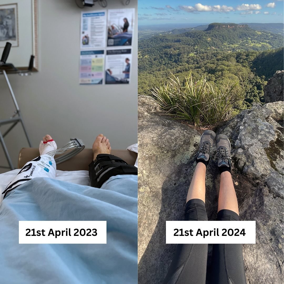 What a difference a year makes. 
It's the first birthday for my new knee. I've swapped crutches for hiking poles and I can't wait to see where else this titanium and polyurethane marvel will take me. Today it was to the top of Dining Room Rocks and I