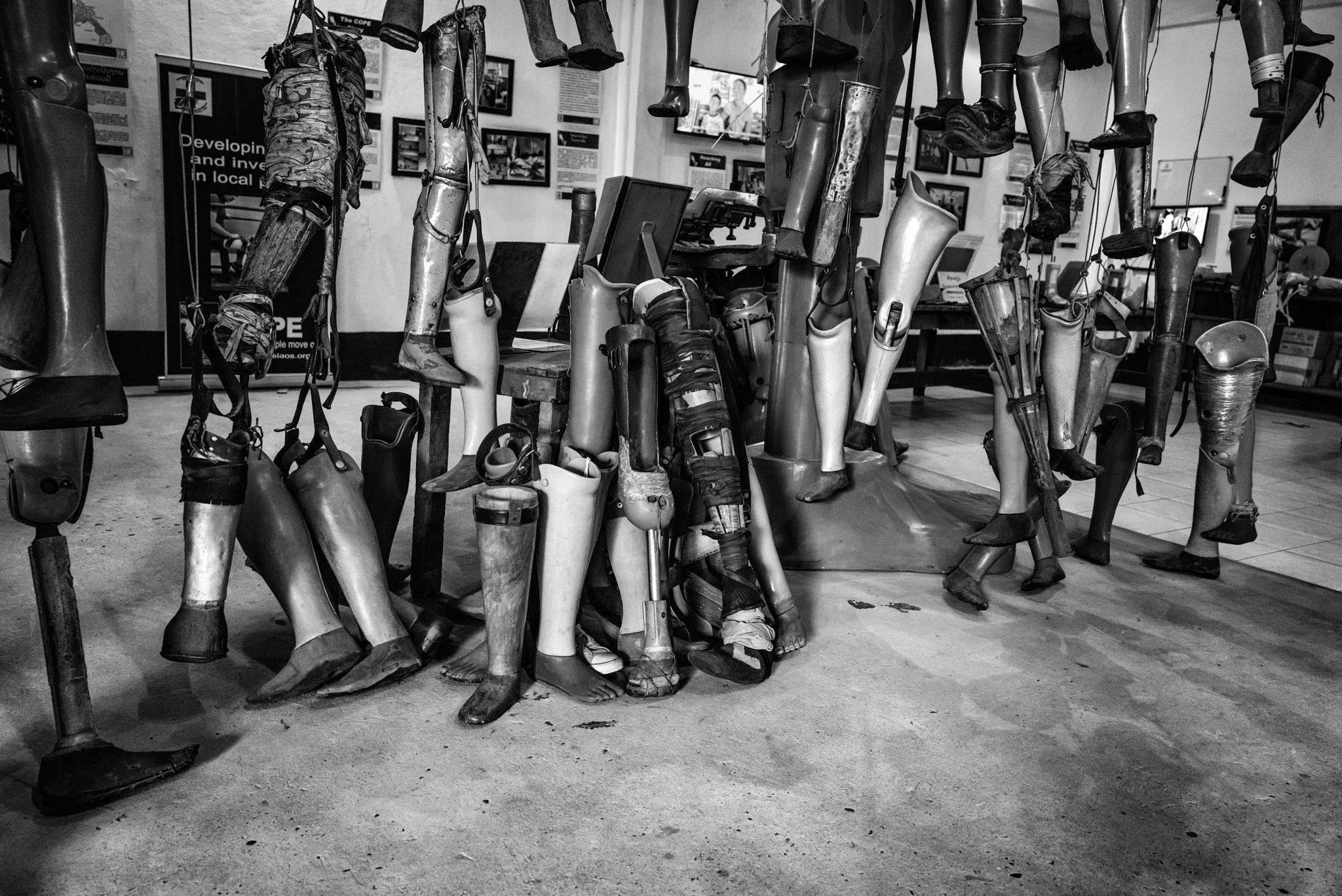 A display of various artificial legs, prosthetics, and crutches in a museum or exhibit setting.